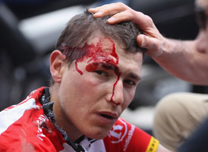 Для Брайковича Тур де Франс окончен Словенец из RadioShack после падения на пятом этапе получил слишком много повреждений.