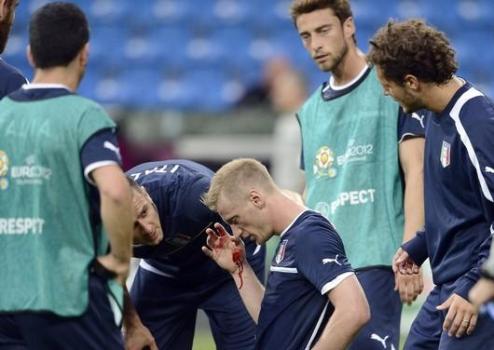 Абате будут зашивать лицо Защитник сборной Италии получил серьезную травму.