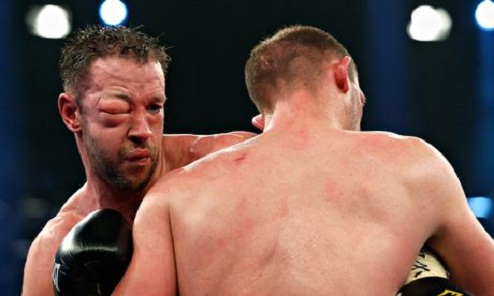 Маккаринелли: "Если бы не травма глаза, я бы победил Бремера" Энцо Маккаринелли (38-7, 30 KO) прокомментировал поражение Юргену Бремеру (43-2, 32 KO).