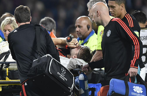 Ужасная травма Шоу. ФОТО На 15 минуте матча против ПСВ Люк Шоу получил серьезную травму в стыке с  Эктором Морено.