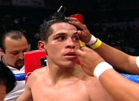 Сосу выписали из больницы Мексиканский боксер сможет продолжить карьеру.