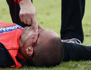 Защитник сборной Англии травмировал голову Центрбэк англичан Мэттью Апсон получил повреждение головы, столкнувшись с партнером по команде во время трени...